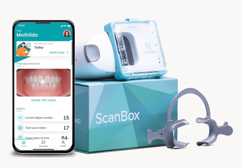 Dental Monitoring - scan your teeth at home - Dentist in Bangor, Newtownards Northern Ireland