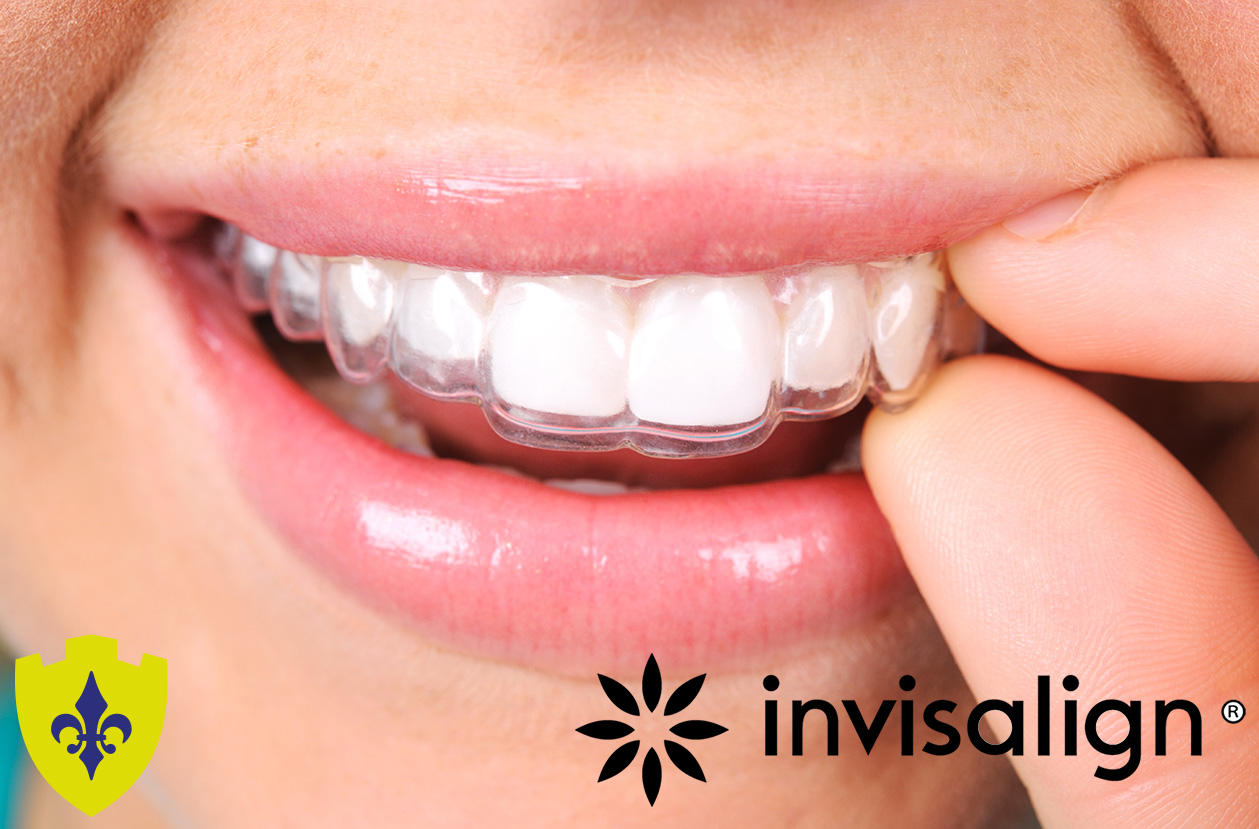 dental checkups in  Bangor and Newtownards
